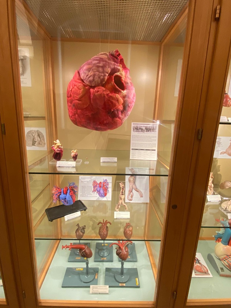 Hinter einer Glasvitrine stehen Exponate der Anatomischen Sammlung des Universitätsklinikums Jena. Zu sehen sind menschliche Herzen, in unterschiedlichen Größen und Zuständen. 