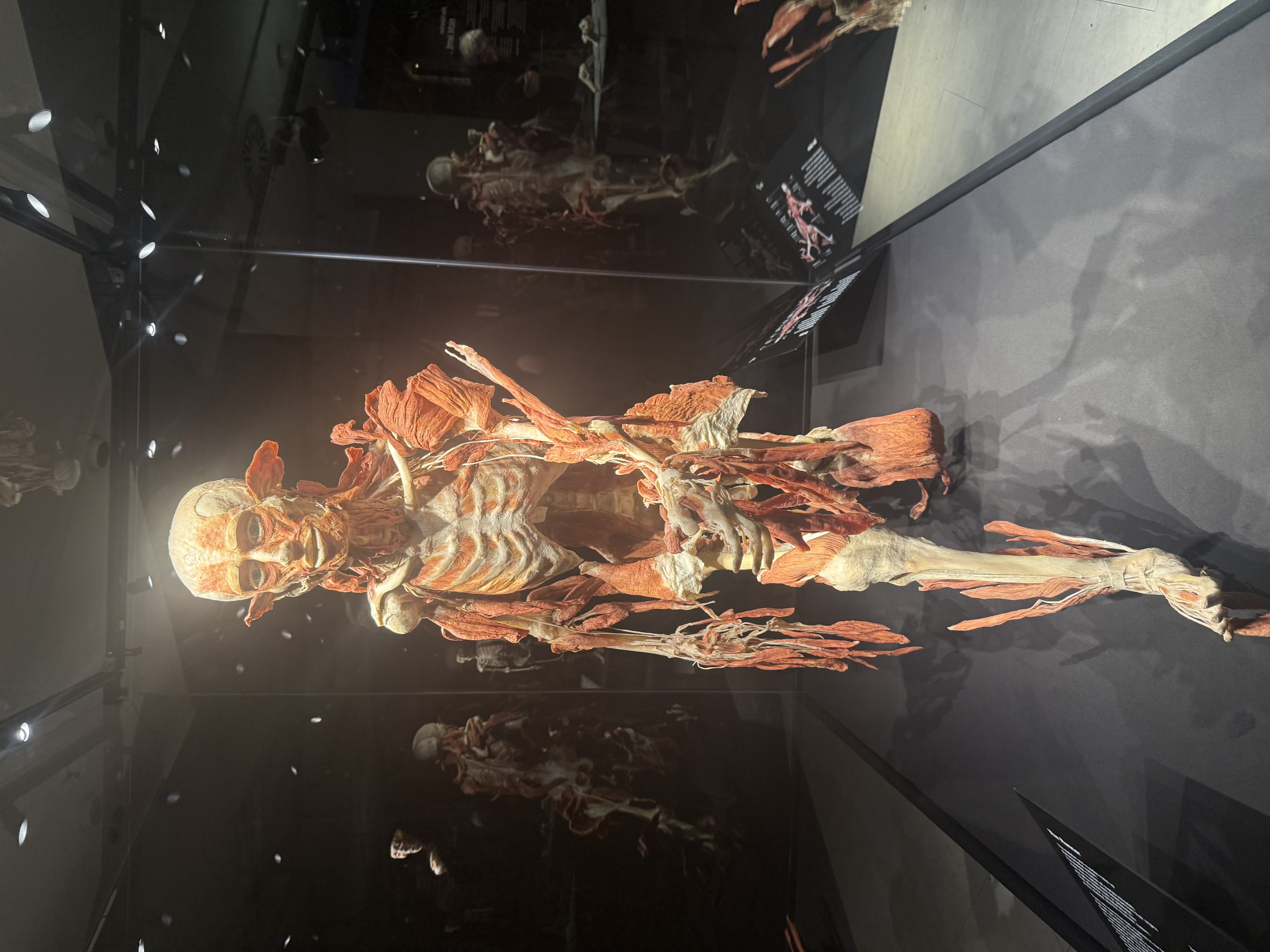 Präparierter menschlicher Körper in einer Glasvitrine, bei dem Muskeln, Sehnen und Teile des Skeletts freigelegt sind; die Figur schreitet nach vorn und zeigt anschaulich den Aufbau der Muskulatur.