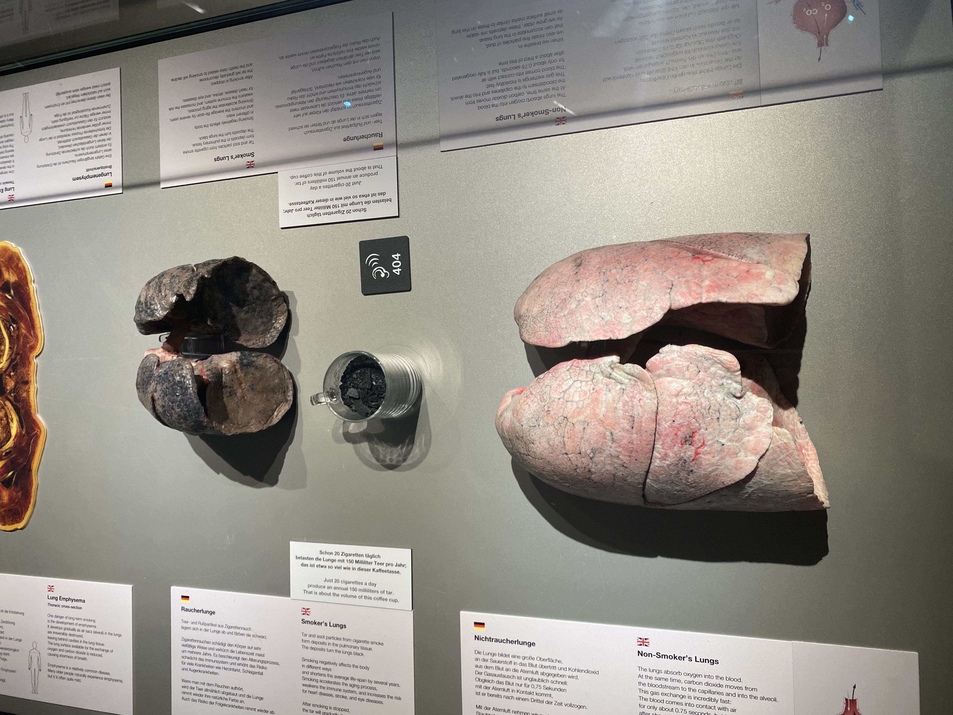 Blick von oben auf zwei echte Lungenpräparate in einer Vitrine – oben eine stark geschädigte, dunkel verfärbte Raucherlunge, unten eine rosafarbene, gesunde Lunge; dazwischen ein Glas mit schwarzem Belag, um die Teerablagerungen zu verdeutlichen, rundherum liegen Infotafeln in Deutsch und Englisch.