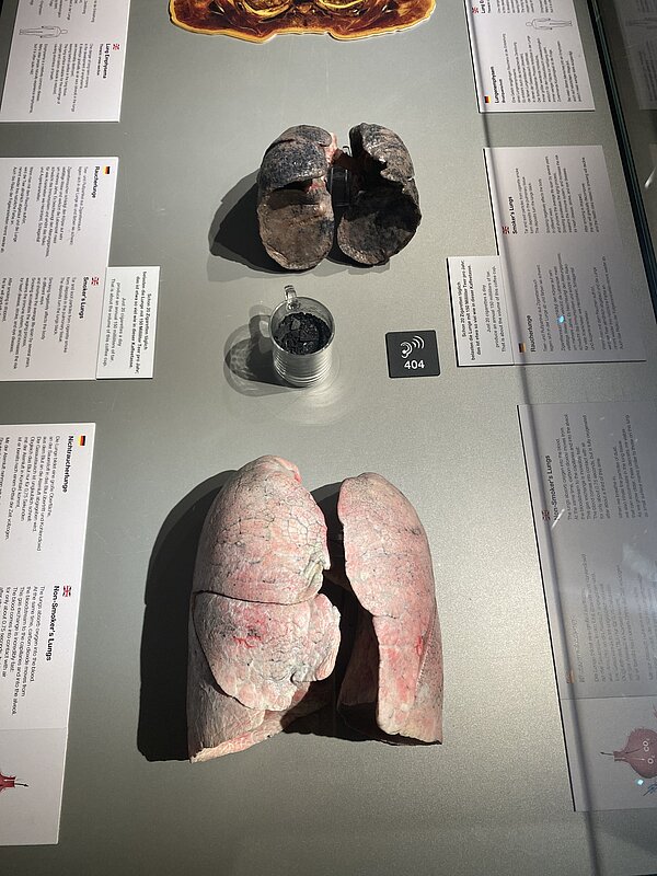Blick von oben auf zwei echte Lungenpräparate in einer Vitrine – oben eine stark geschädigte, dunkel verfärbte Raucherlunge, unten eine rosafarbene, gesunde Lunge; dazwischen ein Glas mit schwarzem Belag, um die Teerablagerungen zu verdeutlichen, rundherum liegen Infotafeln in Deutsch und Englisch.